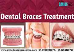Dental Braces Treatment in Faridabad By Experienced Orthodontist