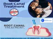 Best Clinic For Painless Root Canal Treatment in Faridabad