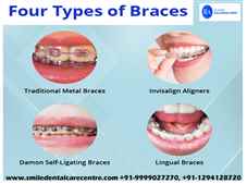 What Are Metal Braces And Clear Aligner Braces Treatment