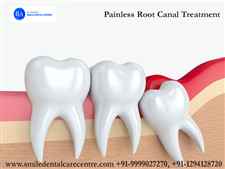 How Many Visits Take To Complete Root Canal Treatment