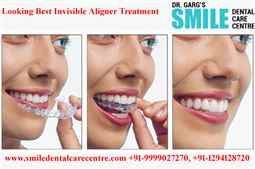 Best Invisible Aligner Treatment By Modern Technology in Faridabad