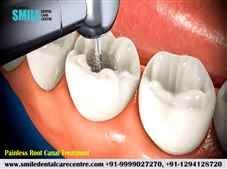 Save Your Teeth By Painless Root Canal Treatment