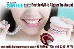 Best Invisible Aligner Treatment Where can I Get Thinking