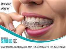 Best Invisible Aligner Treatment Is Possible in Faridabad