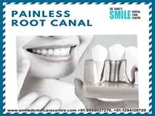 Painless Root Canal Treatment Overview 