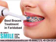 Best Orthodontist is Available for Braces Treatment in our Dental Clinic in Faridabad