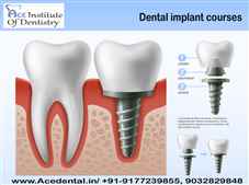 Dental Implantology Courses in India with Latest Technologies