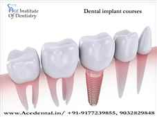 Dental Implant Courses in India With Practical Training