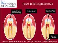 How to do RCTs in Dentistry Where can I Learn