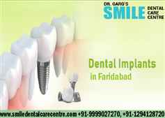 Best Dental Implant Care Centre in Faridabad