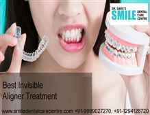 Visit To Get Best Invisible Aligner Treatment Here