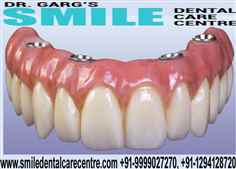 Dental Implant Clinic in Faridabad Painless