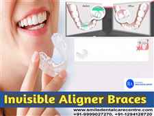 Best Dental Clinic For Invisible Aligner Treatment 