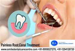 Painless Root Canal Treatment in Faridabad India