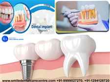 Best Dental Implant clinics in Faridabad and Delhi NCR