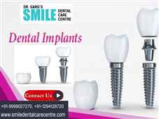 Best Dental Implant Clinic in Faridabad Smile Dental Care