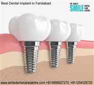 Clinic For Best Dental Implant in Faridabad India